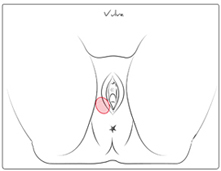 Glande de Bartholin