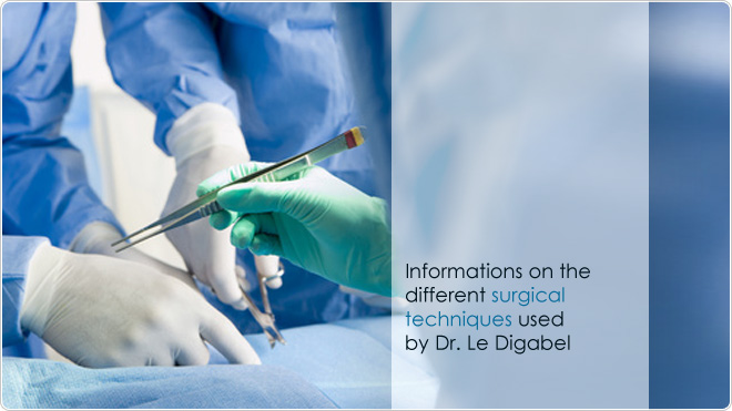 Informations on the different surgical techniques used by Dr. Le Digabel